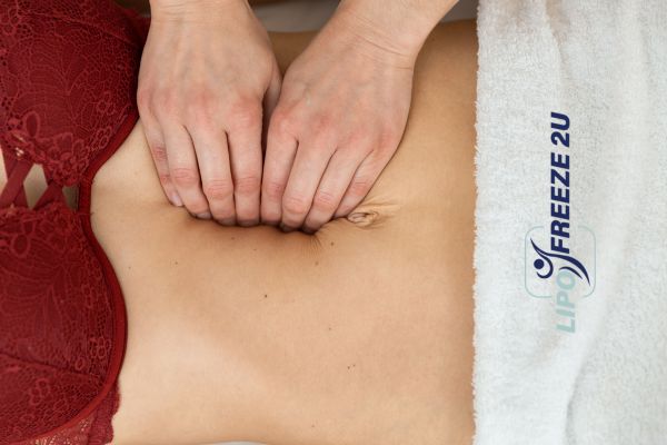 diastasis recti treatment Kent