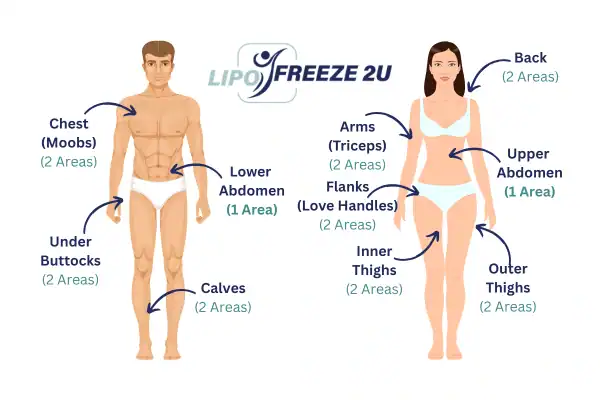 Areas you can have fat freezing treatment Kent
