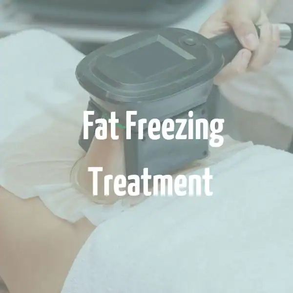fat freezing treatment Kent