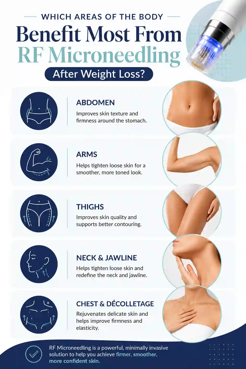 Which Areas of the Body Benefit Most From RF Microneedling After Weight Loss Kent